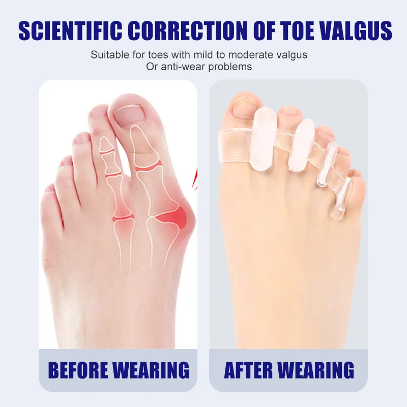 1 çift Silikon Ayak Ayırıcı Bu - Toe Separator Silicon incelemesi ve fiyatı