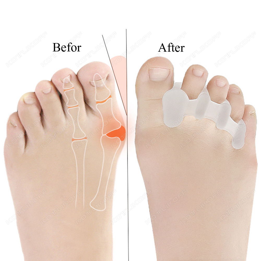 Ayak Koruyucu Ayak Parmakları  - Toe Separator Silicon incelemesi ve fiyatı