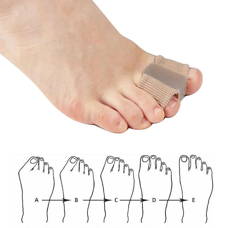 Jel Bunyon Ayak Parmağı Ayırıc - Toe Separator Silicon incelemesi ve fiyatı